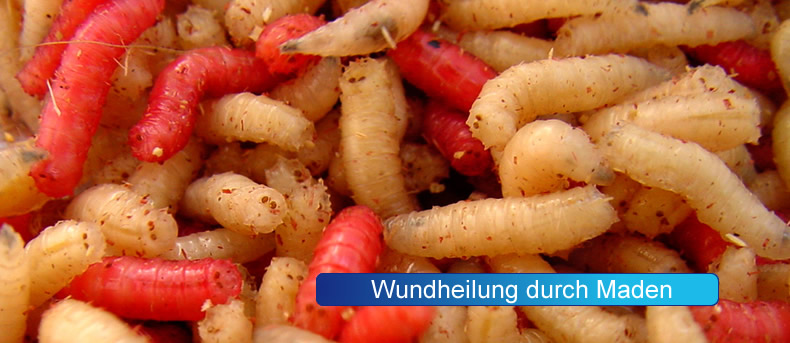 WundheilungdurchMaden